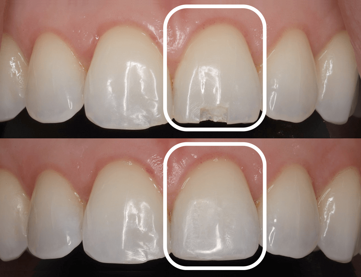 Restoring Smiles with Precision and Care