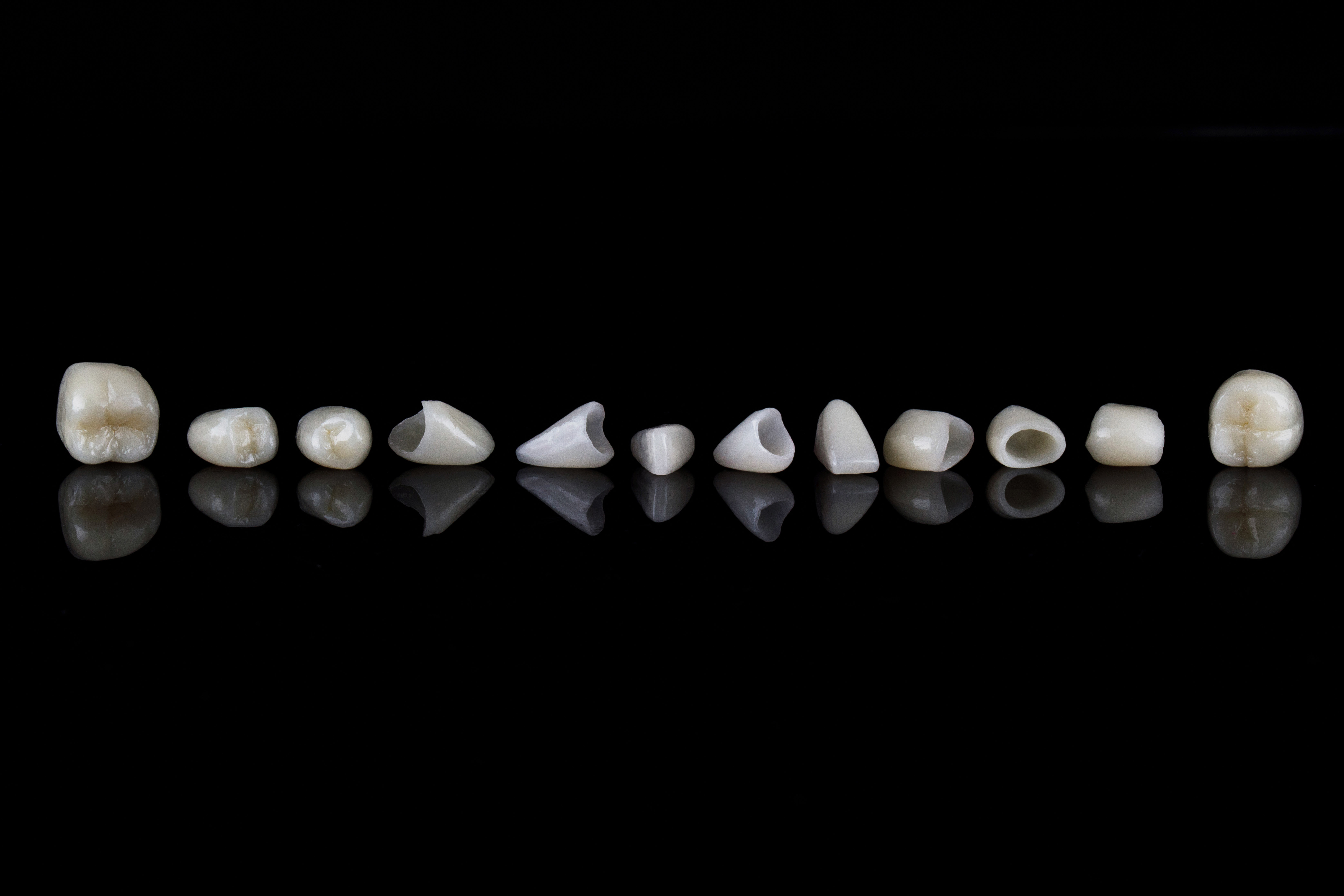 Spaulding Dental Co. - Master Lab Crowns & Veneers