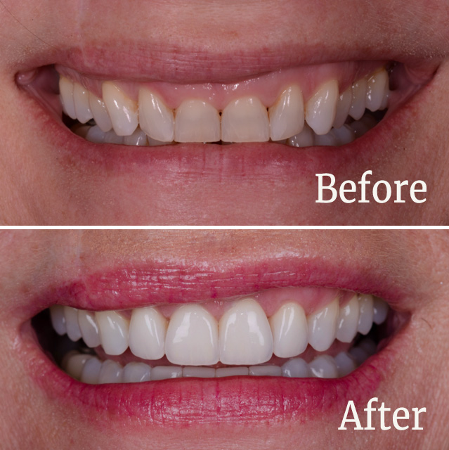 Spaulding - Multidisciplinary Care